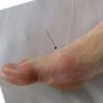 Болит сустав на большом пальце руки: причины боли на правой и левой руке Надавила большой палец на ноге